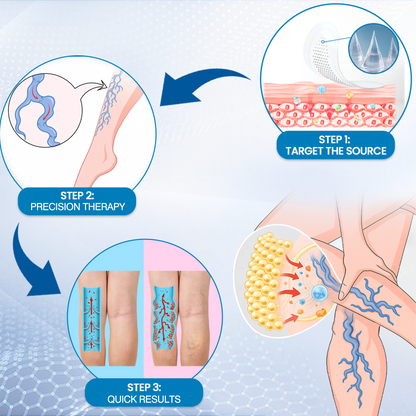🔥Time-Limited Offer -Ourlyard® Vein Ease Microneedle Care Patch - Cuttable (For Spider Veins, Varicose Veins, Swelling & Leg Fatigue)
