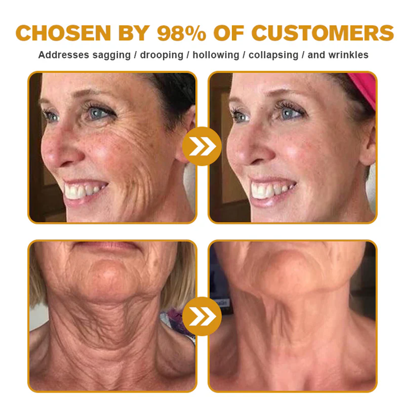 🔥FDA Approved: Ourlyard® Bee Venom Skin Restoration Cream — 🔥Limited Time 80% OFF🔥
