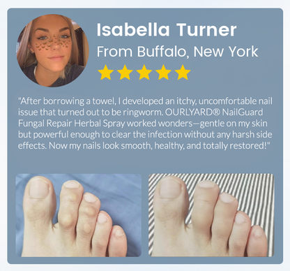 🎁Ourlyard® NailGuard Fungal Repair Herbal Spray