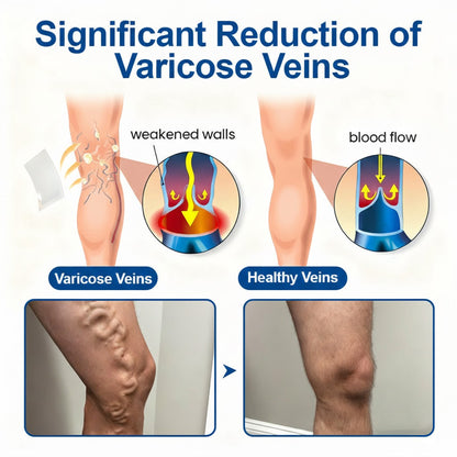 🇺🇸👨‍⚕️🔥GFOUK® VeinEase Microneedle Care Patch⚡Instant Relief, Long-Term Results