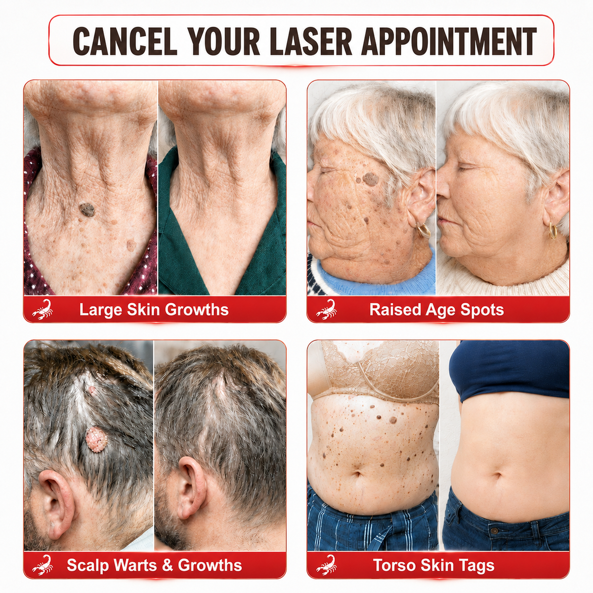𝐎𝐟𝐟𝐢𝐜𝐢𝐚𝐥 𝐁𝐫𝐚𝐧𝐝 𝐒𝐭𝐨𝐫𝐞 |👨‍⚕️🔥 Scorpion Skin Care Cream | Advanced Skin Smoothing Treatment for Spots & Uneven Skin Appearance