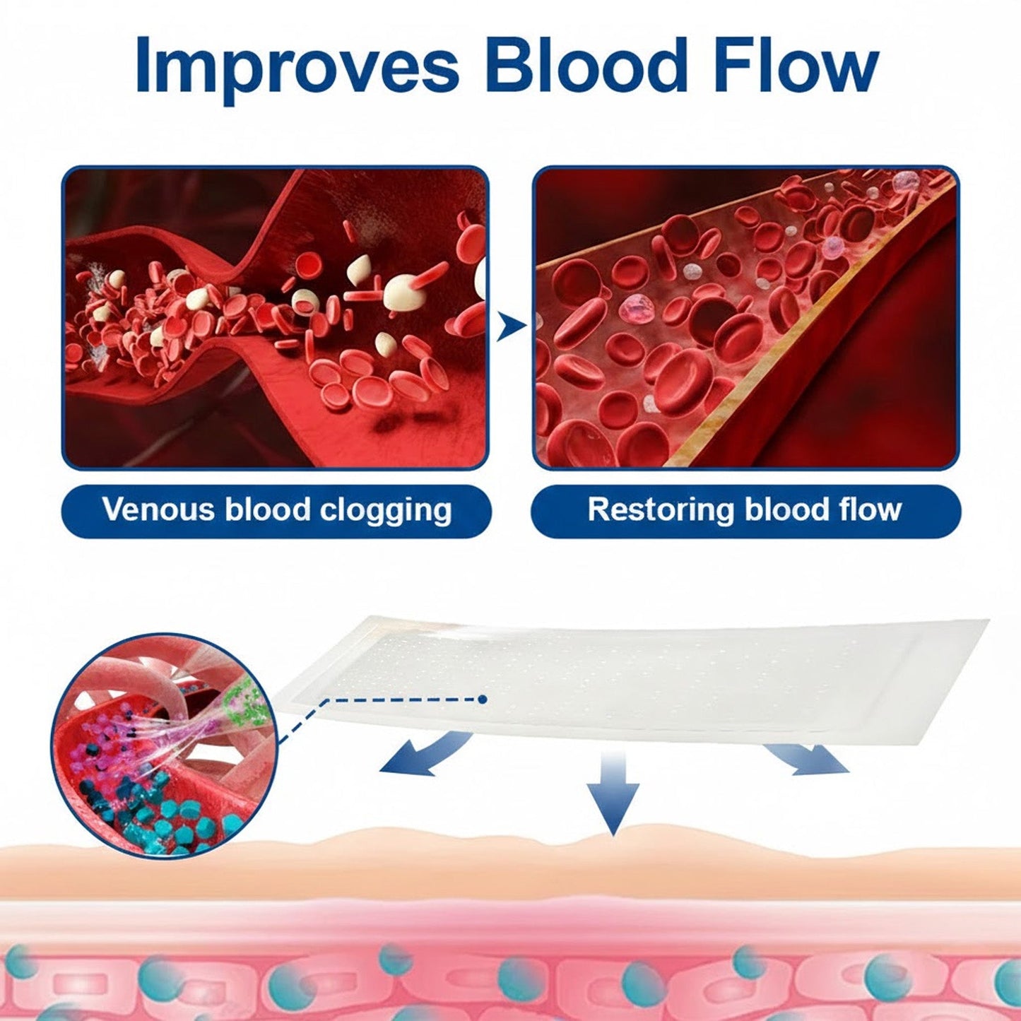 🇺🇸👨‍⚕️🔥GFOUK® VeinEase Microneedle Care Patch⚡Instant Relief, Long-Term Results