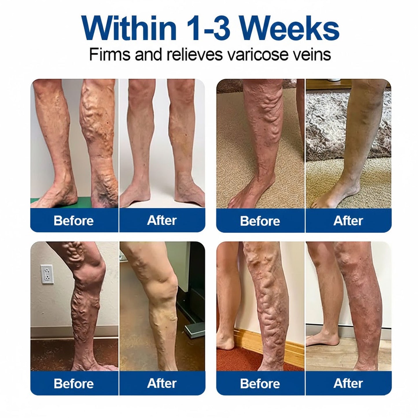 🇺🇸👨‍⚕️🔥GFOUK® VeinEase Microneedle Care Patch⚡Instant Relief, Long-Term Results