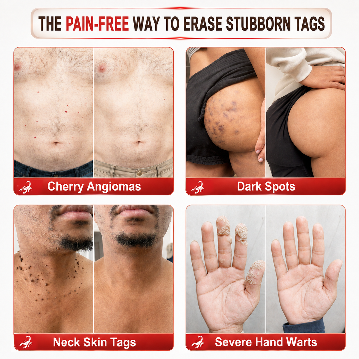 𝐎𝐟𝐟𝐢𝐜𝐢𝐚𝐥 𝐁𝐫𝐚𝐧𝐝 𝐒𝐭𝐨𝐫𝐞 |👨‍⚕️🔥 Scorpion Skin Care Cream | Advanced Skin Smoothing Treatment for Spots & Uneven Skin Appearance