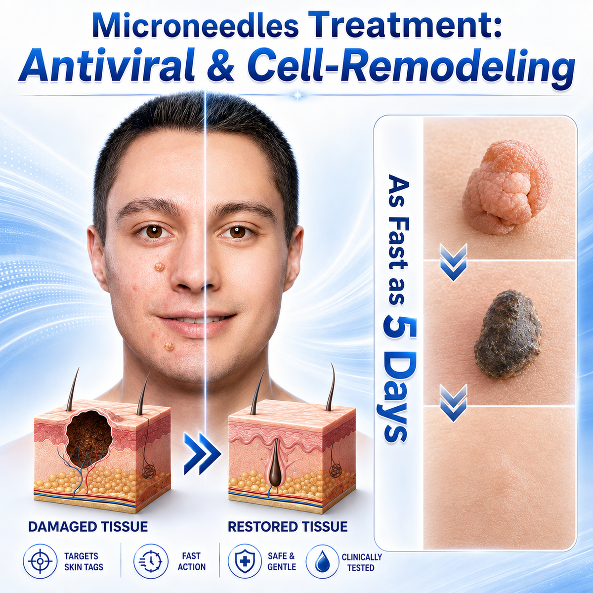 🎁GFOUK® 2026 Newly Upgraded 2-in-1 Microneedle Hydrocolloid Patches | Removes Raised Moles, Acne, Flat Warts, and Skin Tags | Improves Wrinkles, Scars, and Blemishes | Invisible Acne Patches for Face & Body