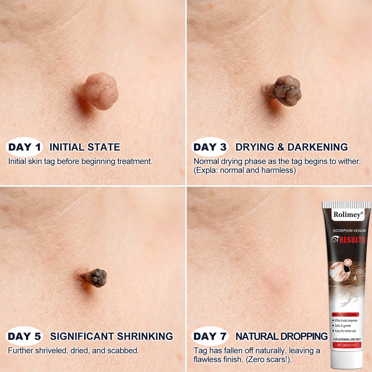 𝐎𝐟𝐟𝐢𝐜𝐢𝐚𝐥 𝐁𝐫𝐚𝐧𝐝 𝐒𝐭𝐨𝐫𝐞 |👨‍⚕️🔥 Scorpion Skin Care Cream | Advanced Skin Smoothing Treatment for Spots & Uneven Skin Appearance