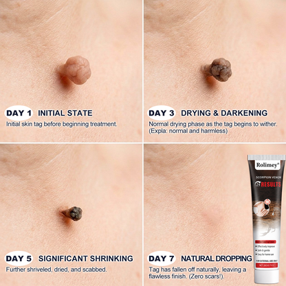 𝐎𝐟𝐟𝐢𝐜𝐢𝐚𝐥 𝐁𝐫𝐚𝐧𝐝 𝐒𝐭𝐨𝐫𝐞 |👨‍⚕️🔥 Scorpion Skin Care Cream | Advanced Skin Smoothing Treatment for Spots & Uneven Skin Appearance