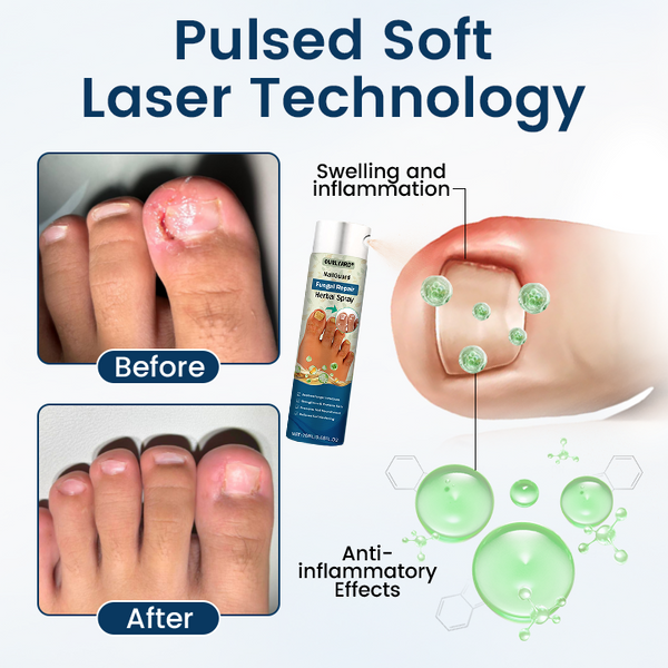 🎁Ourlyard® NailGuard Fungal Repair Herbal Spray