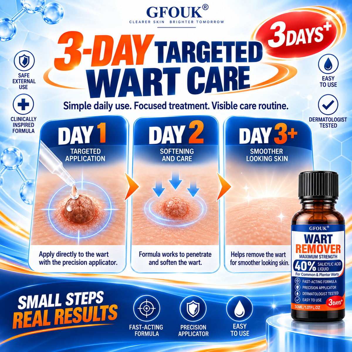 💧GFOUK®40% Salicylic Acid Wart Remover Liquid – Maximum Strength Fast-Acting Treatment for Common, Plantar & Flat Warts, Corns & Calluses, 1.01 fl oz