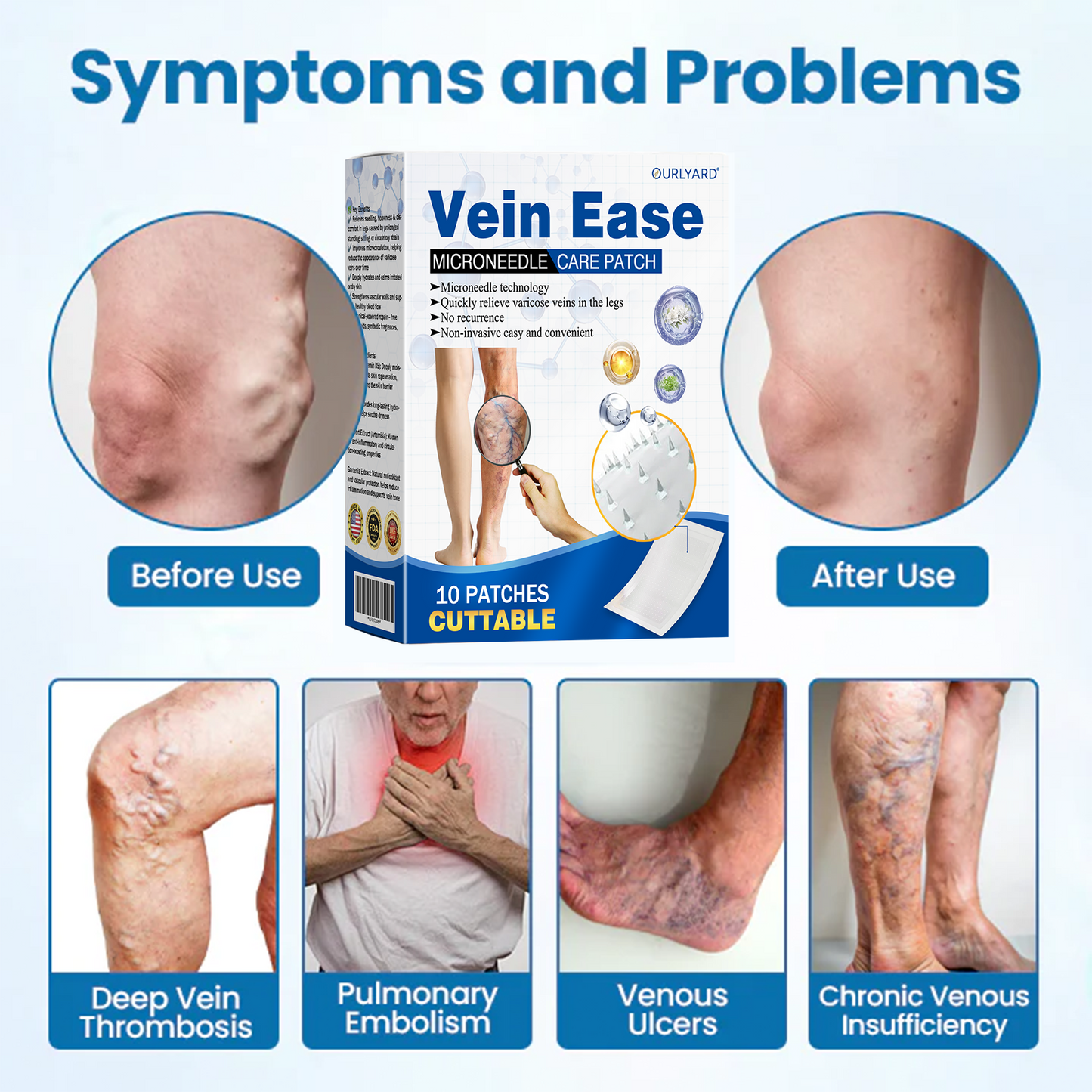 🔥Time-Limited Offer -Ourlyard® Vein Ease Microneedle Care Patch - Cuttable (For Spider Veins, Varicose Veins, Swelling & Leg Fatigue)