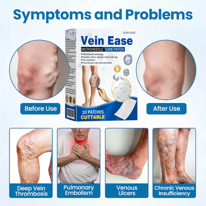 🔥Time-Limited Offer -Ourlyard® Vein Ease Microneedle Care Patch - Cuttable (For Spider Veins, Varicose Veins, Swelling & Leg Fatigue)