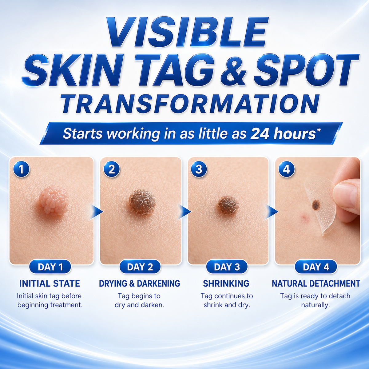 🎁GFOUK® 2026 Newly Upgraded 2-in-1 Microneedle Hydrocolloid Patches | Removes Raised Moles, Acne, Flat Warts, and Skin Tags | Improves Wrinkles, Scars, and Blemishes | Invisible Acne Patches for Face & Body