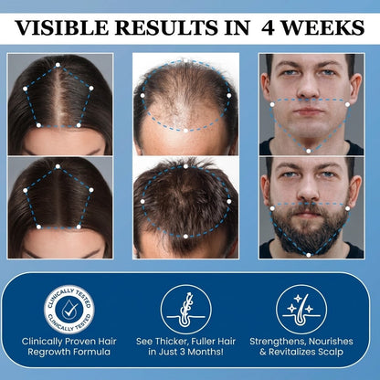 🔥DOCTIA® Hair Growth Roll on Serum | For Hair Growth & Hair Loss Prevention