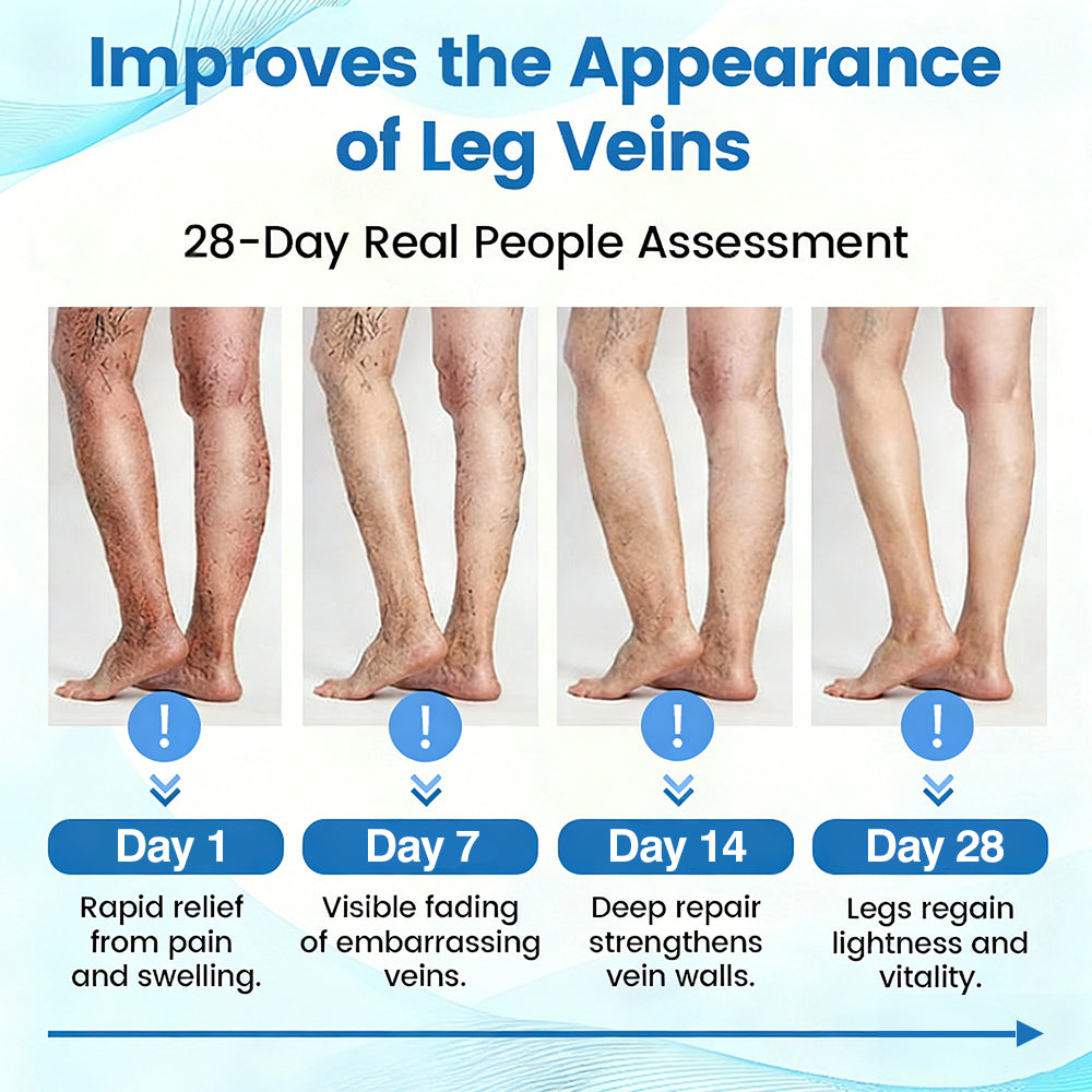 🇺🇸🔥🔥𝗚𝗙𝗢𝗨𝗞® VEINRX Healing Spray(Designed for Varicose veins, Spider veins, Deep vein Thrombosis, Chronic venous insufficiency, Venous ulcers, Thrombophlebitis and other venous issues)