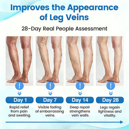 🇺🇸🔥🔥𝗚𝗙𝗢𝗨𝗞® VEINRX Healing Spray(Designed for Varicose veins, Spider veins, Deep vein Thrombosis, Chronic venous insufficiency, Venous ulcers, Thrombophlebitis and other venous issues)