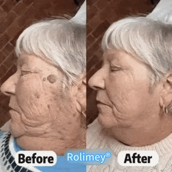 𝐎𝐟𝐟𝐢𝐜𝐢𝐚𝐥 𝐁𝐫𝐚𝐧𝐝 𝐒𝐭𝐨𝐫𝐞 |👨‍⚕️🔥 Scorpion Skin Care Cream | Advanced Skin Smoothing Treatment for Spots & Uneven Skin Appearance