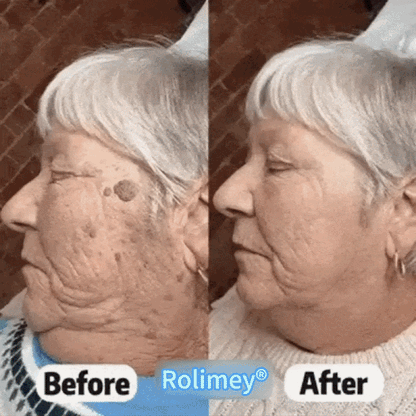 𝐎𝐟𝐟𝐢𝐜𝐢𝐚𝐥 𝐁𝐫𝐚𝐧𝐝 𝐒𝐭𝐨𝐫𝐞 |👨‍⚕️🔥 Scorpion Skin Care Cream | Advanced Skin Smoothing Treatment for Spots & Uneven Skin Appearance